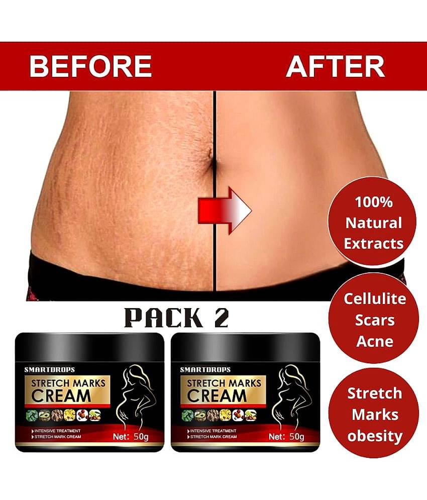 Smartdrops Pragnancy Stretch Mark Remove Cream Shaping & Firming Cream 50 g - Pack of 2