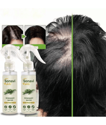 Sonavi Anti Hair Fall Rosemary Oil 200 ml ( Pack of 2 )