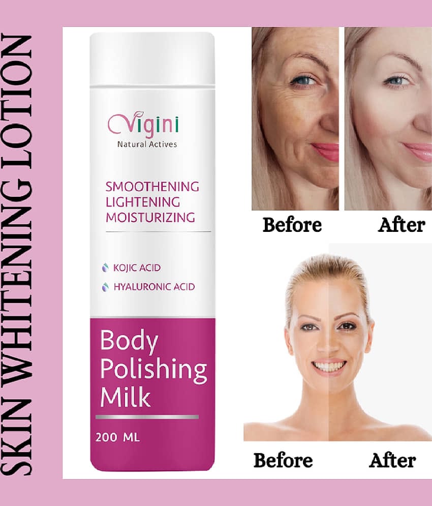 Vigini 100% Natural Active Skin Lightening Whitening Body Polishing Milk Lotion With Kojic & Hyaluronic Acid, UnderArms Under Arms Brightening Cream, Removes / Removal D-Tan Pigmentation Dark Spots For Men & Women-200ml