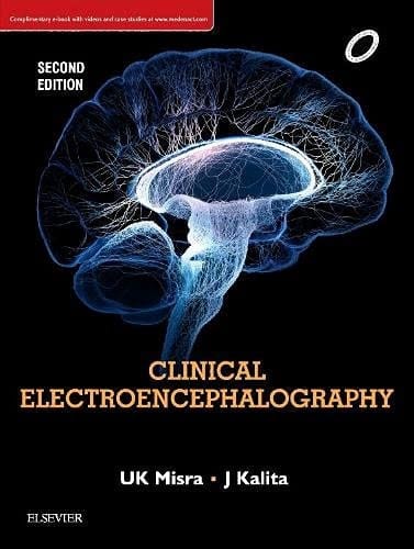 Clinical Electroencephalography, 2nd Edition