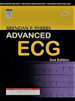 Advanced ECG 2/e