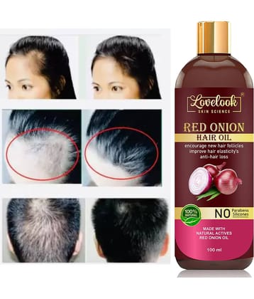 Lovelook - Anti Hair Fall Onion Oil 100 ml ( Pack of 1 )
