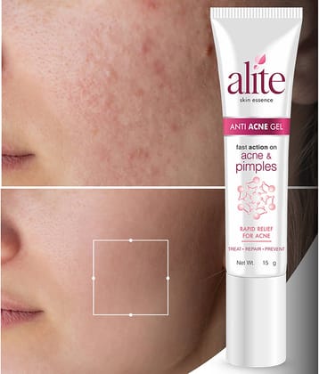Alite Night Cream All Skin Type Tea Tree ( 15 gm )