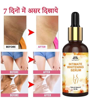 Intimify Intimate Area Whitening, Neck Whitening, Intimate Area Lightening V Tightening , 30 Ml