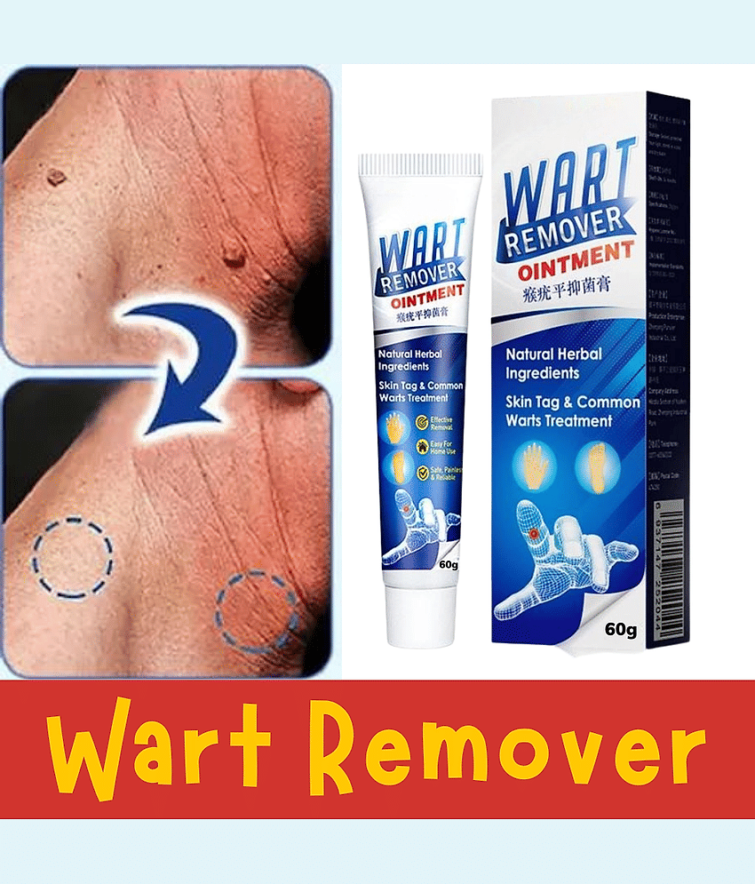 Wart Removal Ointment Treatment for Remove Warts Moles & Acne Safely Painless