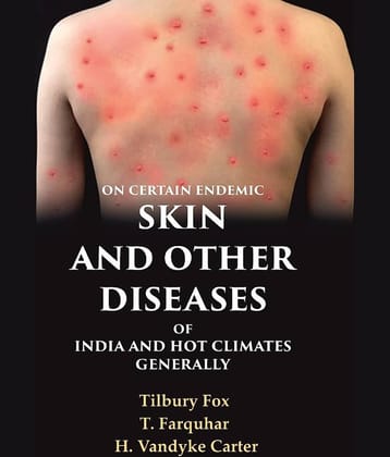 On Certain Endemic Skin and Other Diseases of India and Hot Climates Generally