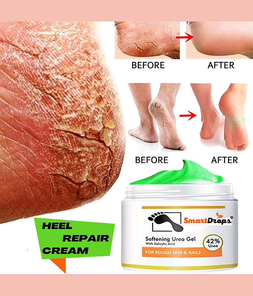 Smartdrops Chapped Hand And Foot Cream Crack Peeling Repair Anti Dry Skin Remove Dead Skin Foot Moisturizing (50gm) Pack of 2