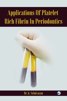Applications of Platelet rich fibrin in Periodontics [Paperback] Dr. K. Srinivasan