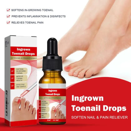 Ingrown Toenail Softening & Care Drops | Nail Softener & Foot Hygiene Solution | Helps Reduce Discomfort, Prevents Inflammation, Disinfects & Supports Nail Health