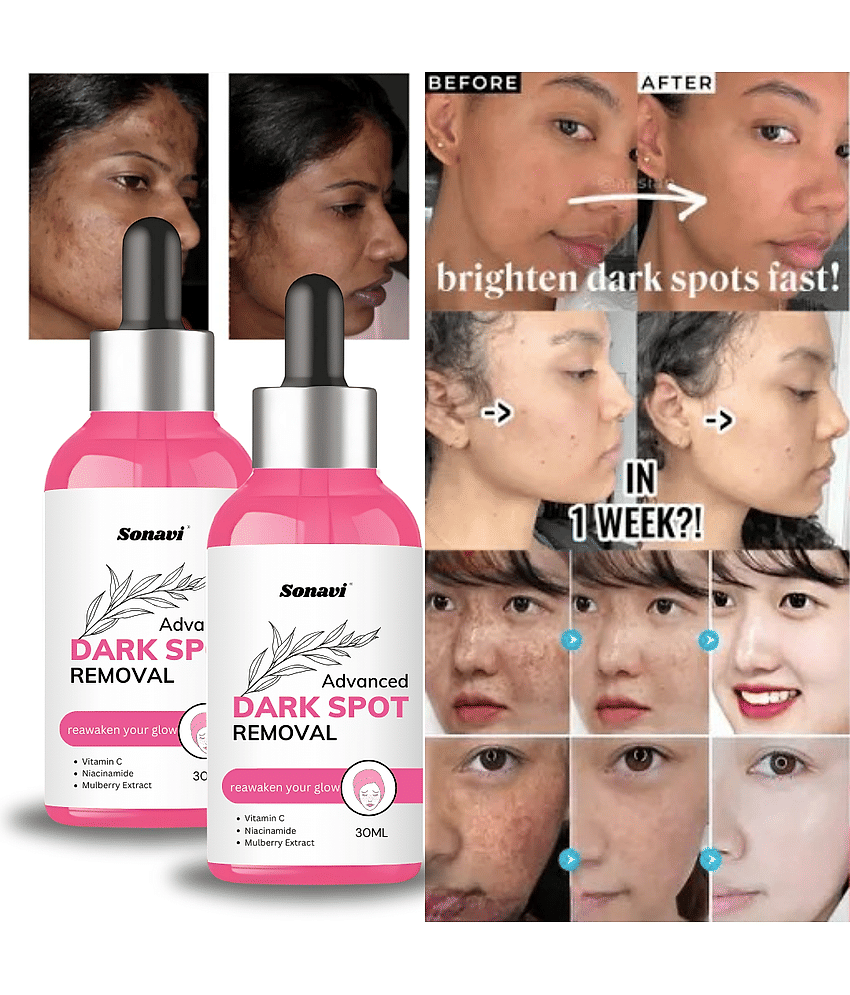 Sonavi Face Serum Niacinamide Spot Removal For All Skin Type ( Pack of 2 )