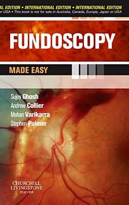 FUNDOSCOPY