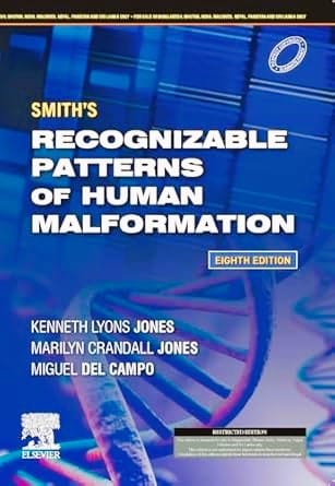 Smith's Recognizable Patterns of Human Malformation: Expert Consult - Online and Print, 8ed