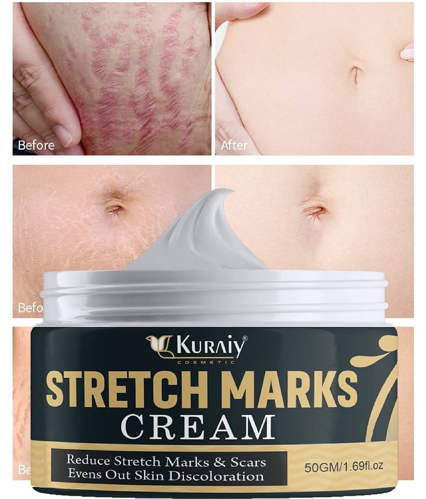 Kuraiy Natural Stretch Oil with Coconut, Olive & Jojoba Oils, For Scars & Stretchmark Oil
