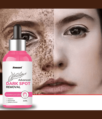 Sonavi Face Serum Niacinamide Spot Removal For All Skin Type ( Pack of 1 )