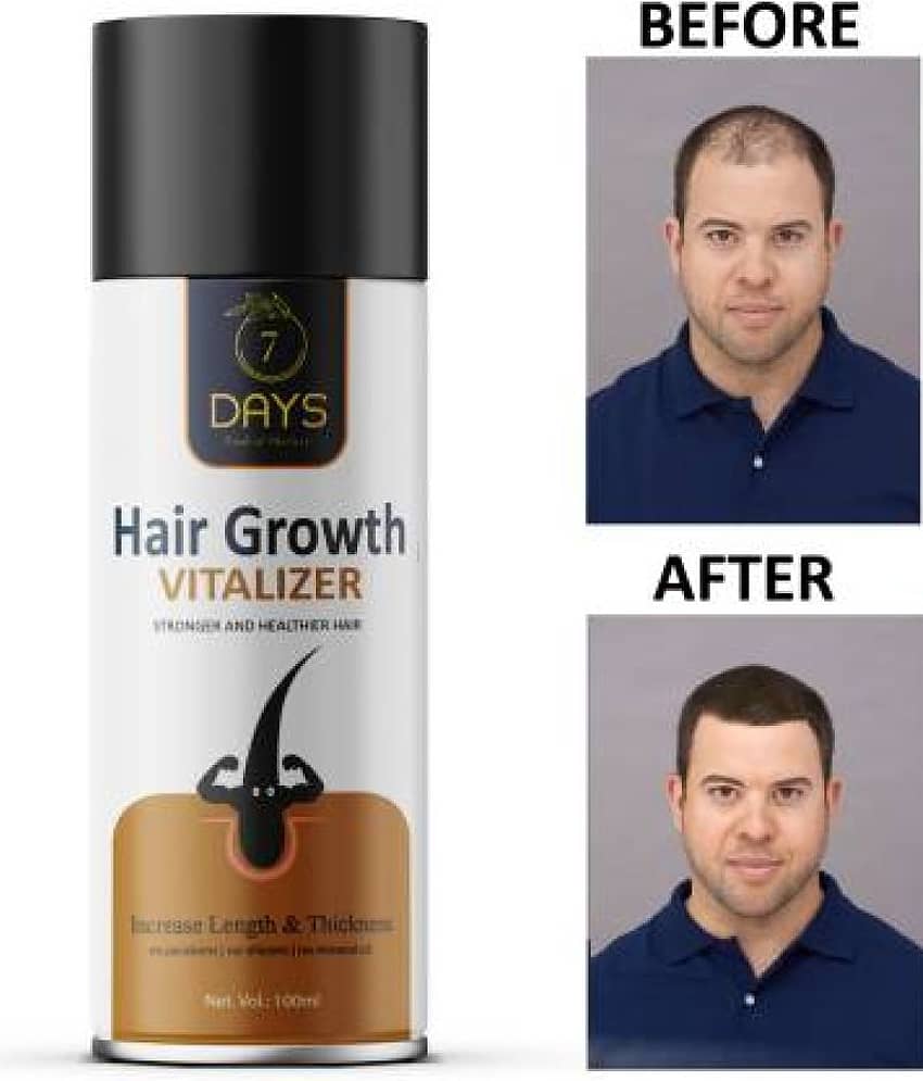 7Days Hair Vitalize For Strong and Healthy Hair Growth, For Men, 100ml