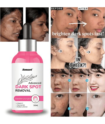Sonavi Face Serum Vitamin C Maintians Skin Complexion For All Skin Type ( Pack of 1 )