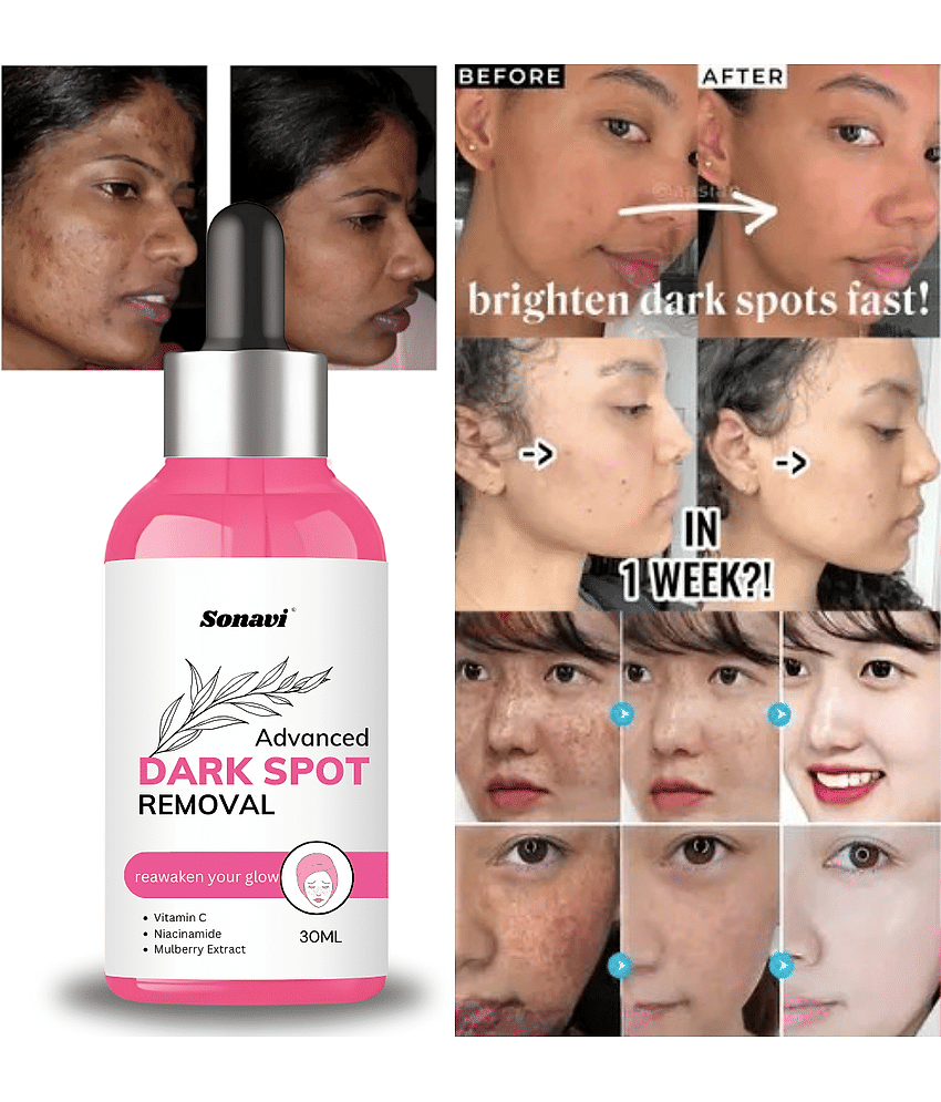 Sonavi Face Serum Vitamin C Maintians Skin Complexion For All Skin Type ( Pack of 1 )