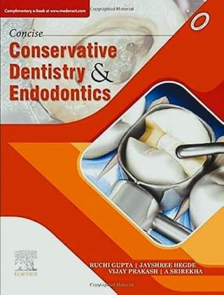 Concise Conservative Dentistry and Endodontics, 1ed
