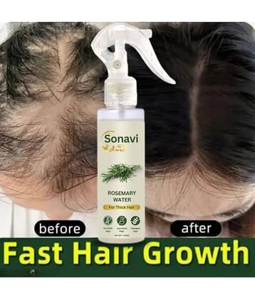 Sonavi Hair Growth Rosemary Oil 100 ml ( Pack of 1 )