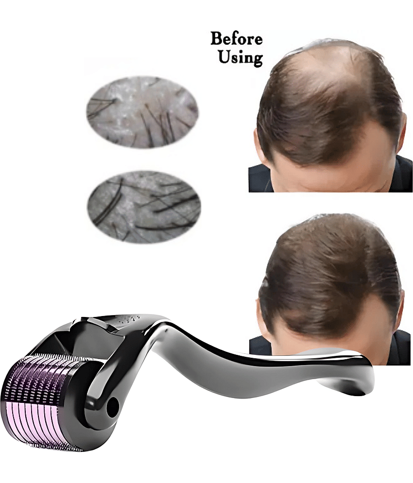 Derma Roller for Hair Growth Wrinkles  Face Microdermabrasion | 0.5mm Titanium Alloy 540 Micro Needles For Scalp & Beard