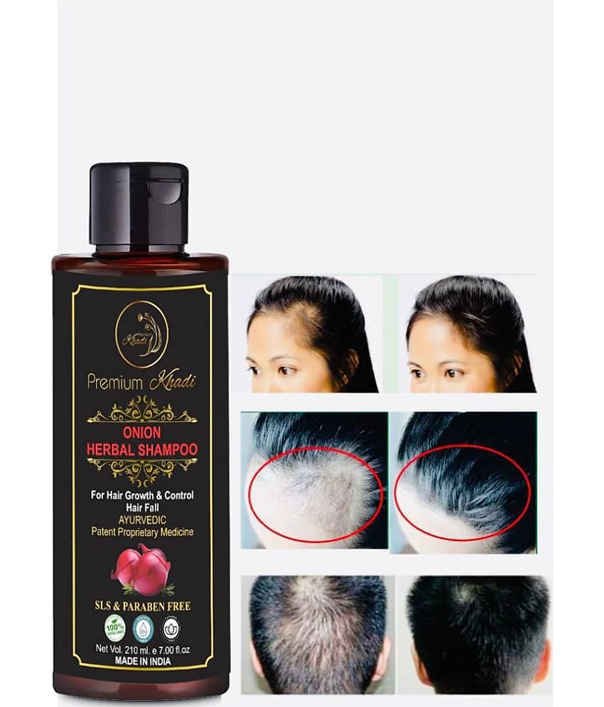 Premium Khadi Onion Shampoo For Hair Growth With Aloevera, Argan oil SLS & Paraben Free Shampoo 210 mL