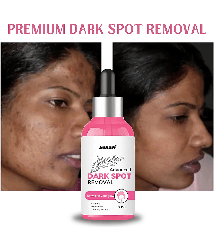 Sonavi Face Serum Niacinamide Moisturizing For All Skin Type ( Pack of 1 )