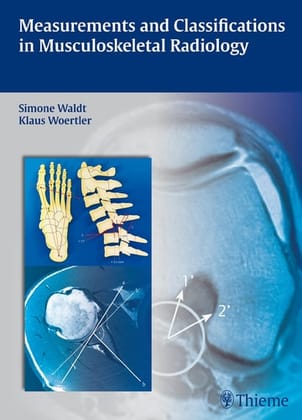 Measurements and Classifications in Musculoskeletal Radiology 1/ed