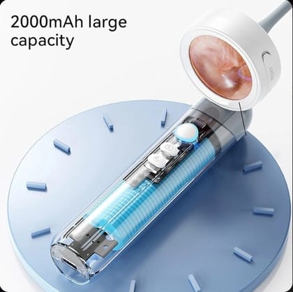 Digital Video Otoscope with USB for PC View and Own screen Play Digital Video Otoscope with USB for PC View and Own screen Play