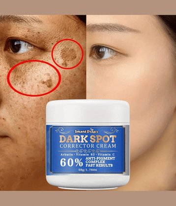 Smartdrops - Night Cream for All Skin Type 50 gm ( Pack of 1 )