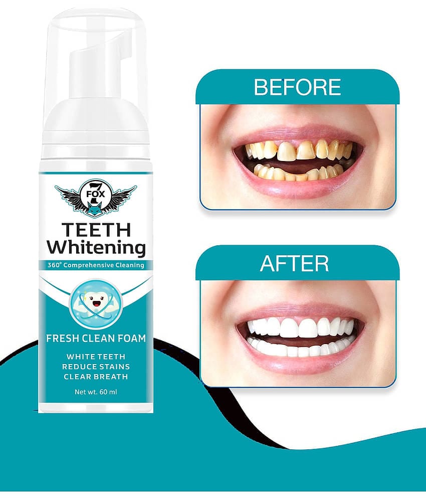 7 FOX Teeth Whitening Foam with Mint to Remove Breath Freshener Spray Mint 60 g