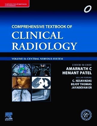 IRIA- Comprehensive Textbook of Clinical Radiology, Volume II: Central Nervous System