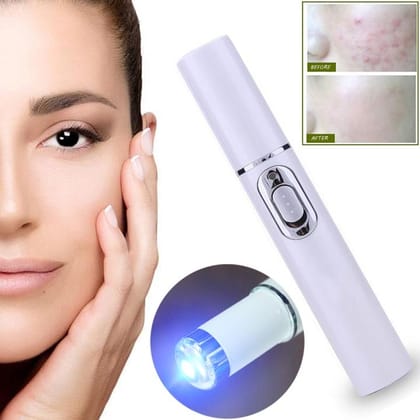 Laser Spot Remover Pen - Acne, Scars and Wrinkles Removal-China