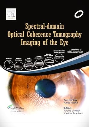 Spectral Domain Optical Coherence Tomography Imaging of the Eye, 1ed