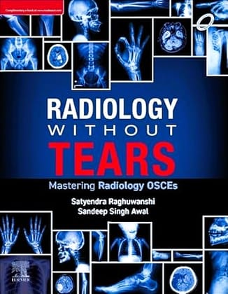 Radiology Without Tears: Mastering Radiology OSCE'S
