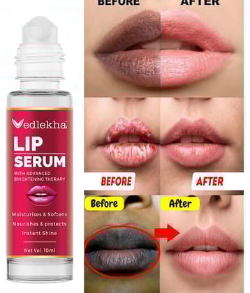 Vedlekha Face Serum Niacinamide Daily Care For All Skin Type ( Pack of 1 )