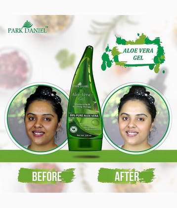 Park Daniel Premium 99% Pure Aloe Vera Gel Face Moisturizer & Lotion 130 ml