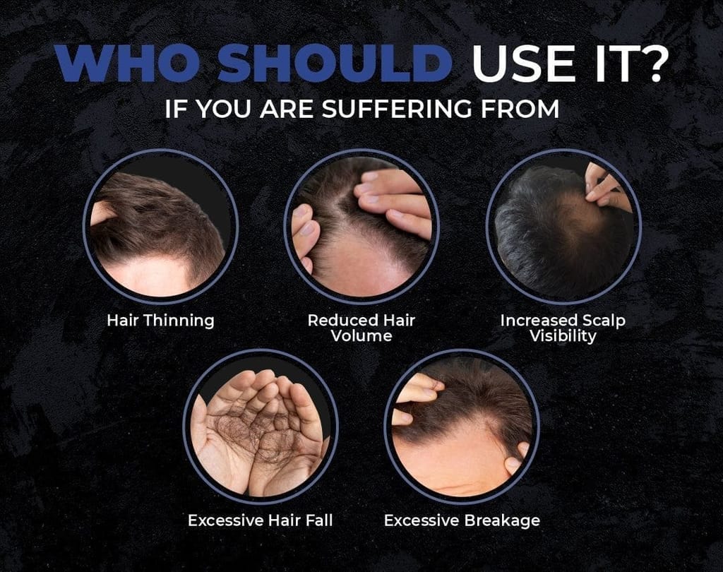 Beardo Hair Growth Combo