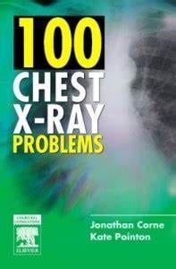 100 Chest X-Ray Problems 1st Edition 2006