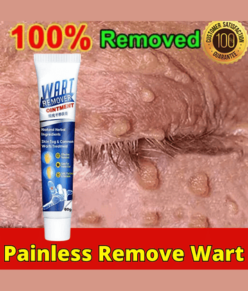 Massa Wart Remover Cream For Skin For Wart Free Skin For Men Or Women