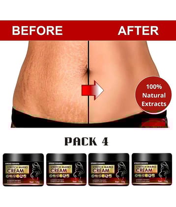 Smartdrops Pragnancy Stretch Mark Remove Cream Shaping & Firming Cream 50 g - Pack of 4