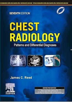 Chest Radiology: Patterns and Differential Diagnoses, 7ed