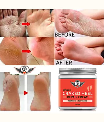 7 FOX Cracked Heel Repair Specialist Cream Smooth Feet, Foot Cream,100ml