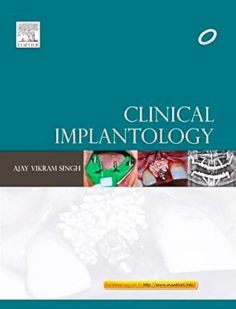 Clinical Implantology 1ed