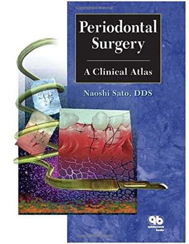 Periodontal Surgery: A Clinical Atlas 1st Edition 2000