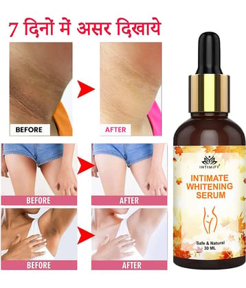 Intimify Intimate Area Whitening, Neck Whitening, Intimate Area Lightening V Tightening , 30 Ml