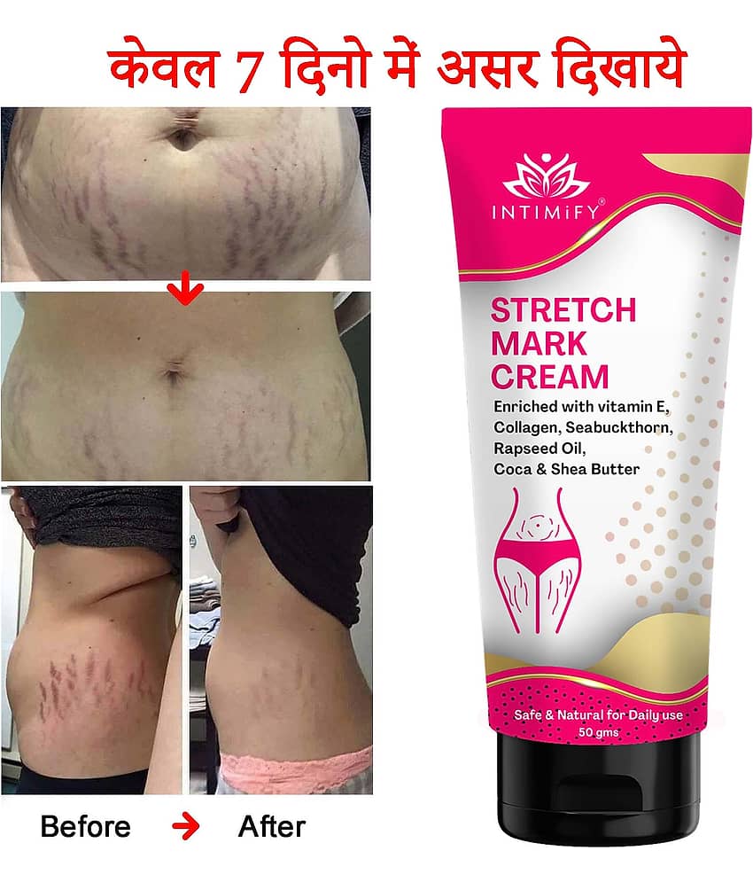 Intimify Stretch Mark Remover Cream, Stretch Mark Cream, Shaping & Firming Cream 50 gms