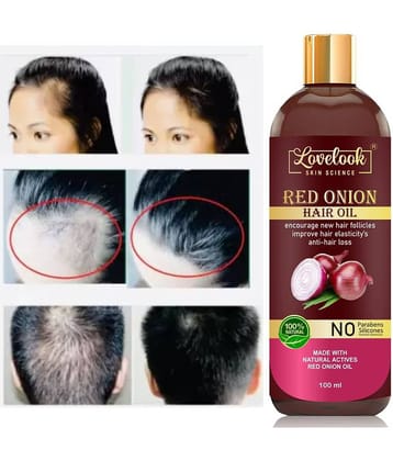 Lovelook Onion Oil for Hair Growth & & Hair Fall Control 100 mL