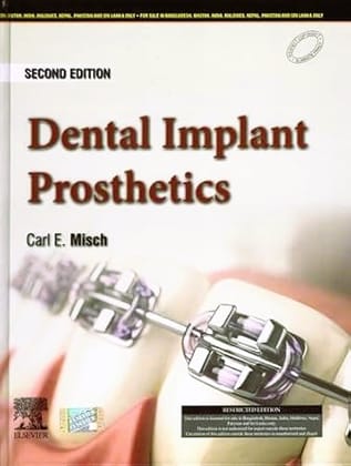 Dental Implant Prosthetics:  2ed