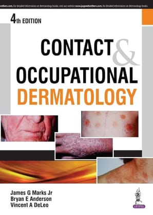 Contact and Occupational Dermatology 4th Edition 2016