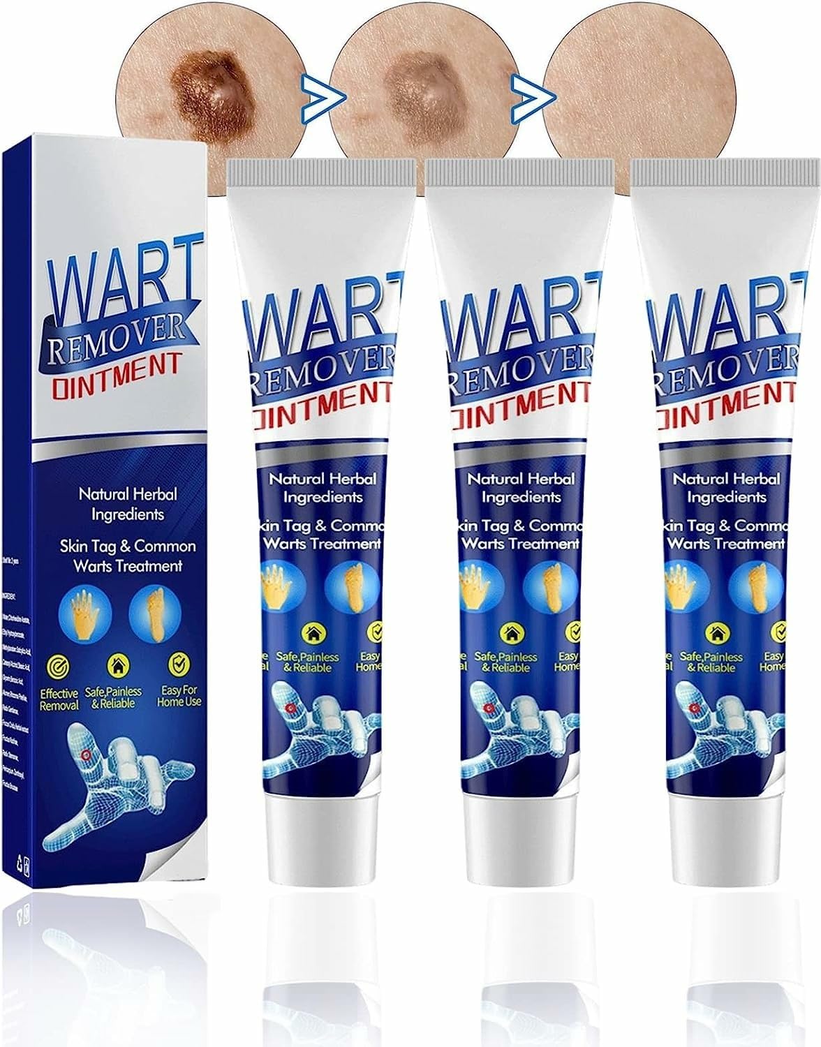 Elecsera Warts Remover Cream Skin Face Tag Treatment Ointment For Men Women (Pack of 3) (300 g)